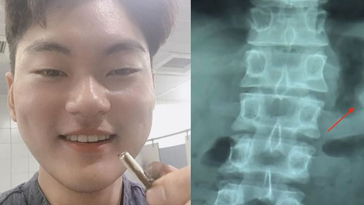 অ্যাপল এয়ারপড