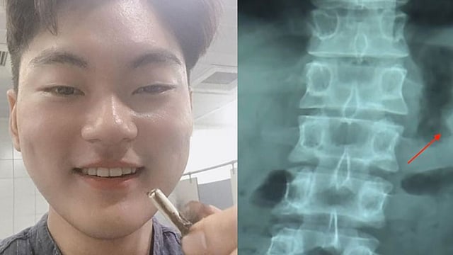 অ্যাপল এয়ারপড