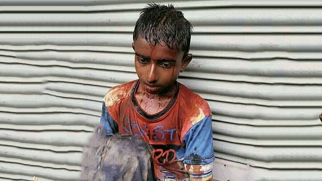 দুর্বৃত্তদের আঘাতে রক্তাক্ত শাহীন। ছবি: সংগৃহীত