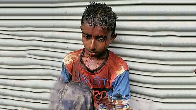 দুর্বৃত্তদের আঘাতে রক্তাক্ত শাহীন। ছবি: সংগৃহীত