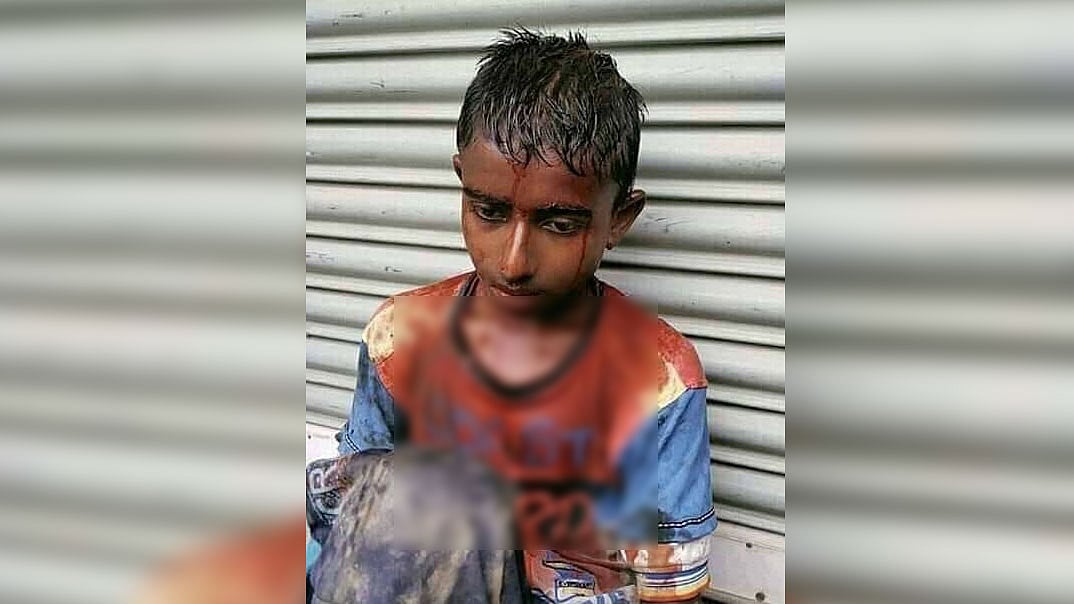 দুর্বৃত্তদের হামলায় আহত শাহীন। ছবি: সংগৃহীত