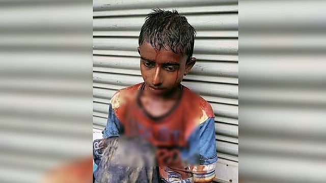 দুর্বৃত্তদের হামলায় আহত শাহীন। ছবি: সংগৃহীত