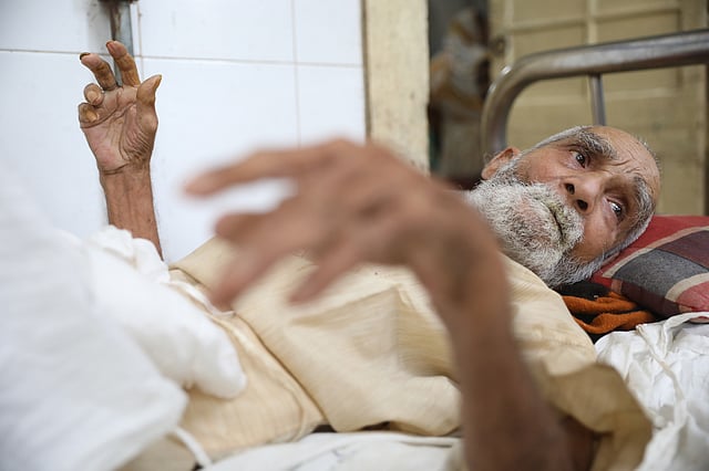 ফ্যালফ্যাল করে তাকিয়ে থাকেন আবদুর রহমান। ঢাকা মেডিকেল কলেজ হাসপাতাল, ঢাকা, ১৬ সেপ্টেম্বর। ছবি: আবদুস সালাম