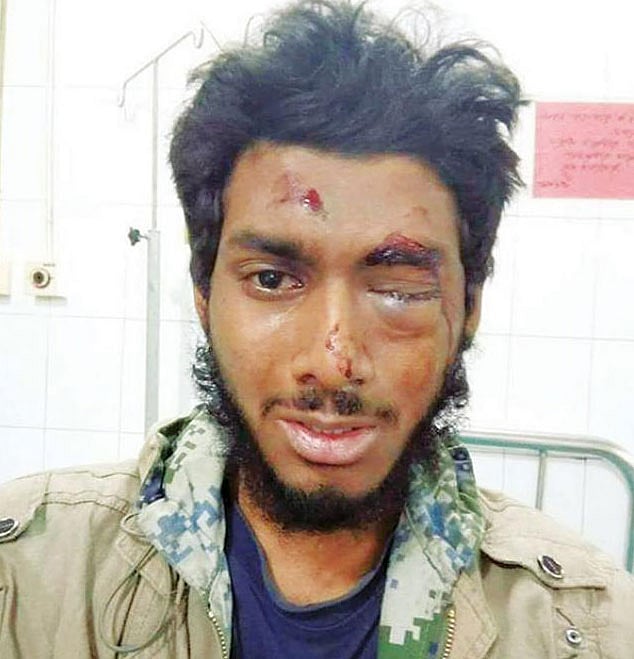 ২০১৮ সালে ঢাবির এসএম হলে ছাত্রলীগের নেতা-কর্মীদের নির্যাতনের শিকার হন এহসান রফিক। এতে এহসানের একটি চোখের কর্নিয়া গুরুতর জখম হয়। তাঁর কপাল ও নাক ফেটে যায়।