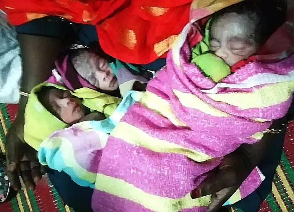 একসঙ্গে ভূমিষ্ঠ হওয়া চার সন্তানের মধ্যে বেঁচে আছে তিনজন। ছবি: সংগৃহীত