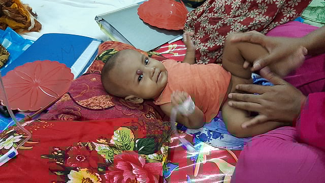 ঢাকা মেডিকেল কলেজ হাসপাতালের শিশু সার্জারি বিভাগ অনেকটা শেষ আশ্রয়স্থল হিসেবে কাজ করছে। ছবি: প্রথম আলো