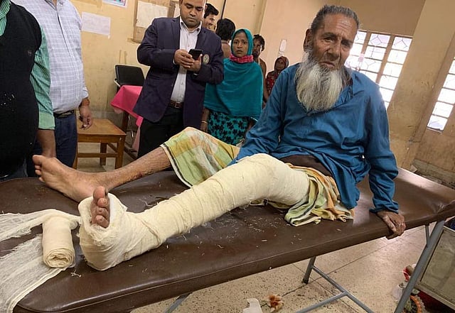 অস্ত্রোপচারের মাধ্যমে তাঁর পা থেকে রডগুলো খোলা হয়। ছবি: সংগৃহীত