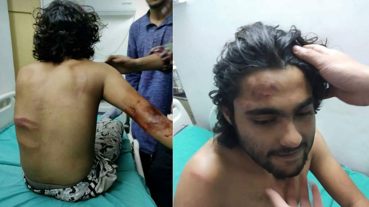 বিশ্বভারতী বিশ্ববিদ্যালয়ের বিদ্যাভবন ছাত্র হোস্টেলে বামপন্থী ছাত্রসংগঠন এসএফআইয়ের নেতা-কর্মীদের ওপর বিজেপির ছাত্রসংগঠন এবিভিপি হামলা চালায় বলে অভিযোগ উঠেছে। ছবি: টুইটার