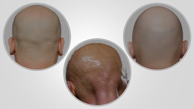 প্রতীক ছবি।