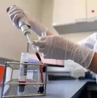 প্লাজমা থেরাপি। ফাইল ছবি