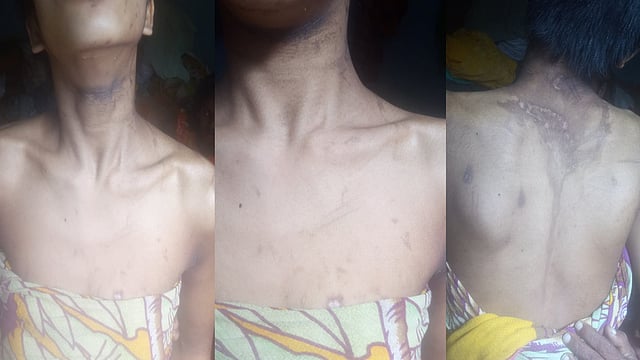 নির্যাতনের শিকার কিশোরী। ছবি: সংগৃহীত