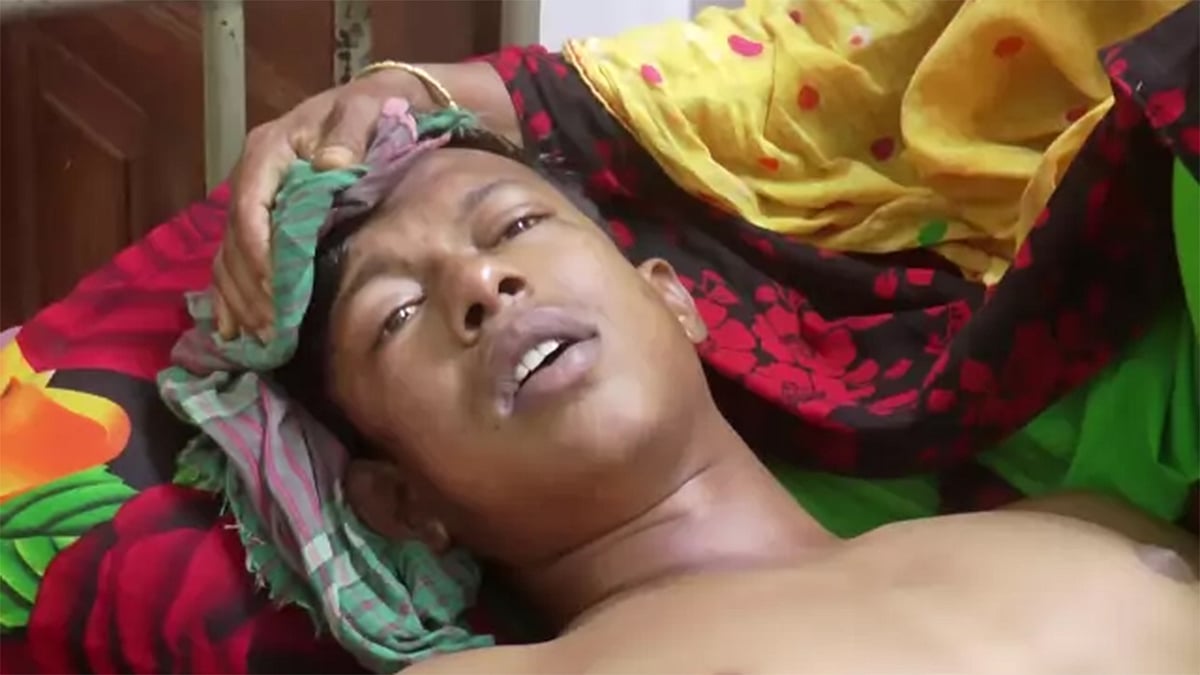 হাসপাতালে চিকিৎসাধীন কলেজছাত্র ইমরান হোসেন। সোমবার যশোর শহরের কুইন্স হাসপাতালে। প্রথম আলো ফাইল ছবি