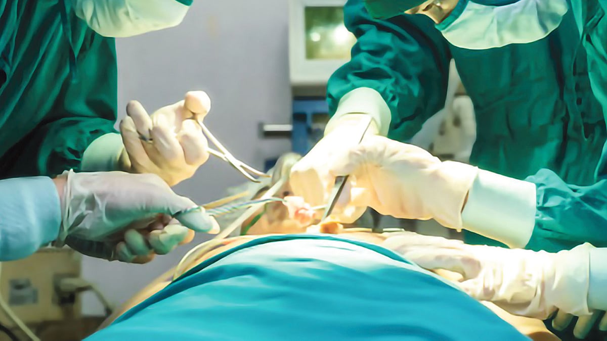 চাঁদপুরে এক নারীর পেট থেকে ৮ কেজি ওজনের টিউমার অপসারণ