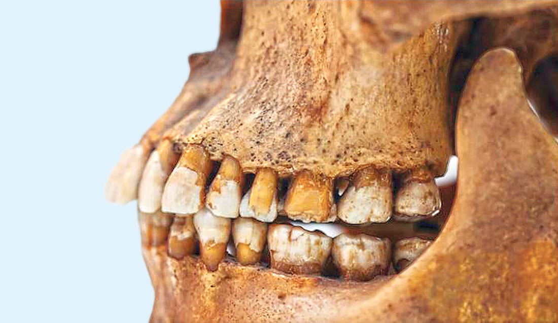 প্রস্তরযুগের মানুষের দাঁত।  ওয়াশিংটন পোস্ট