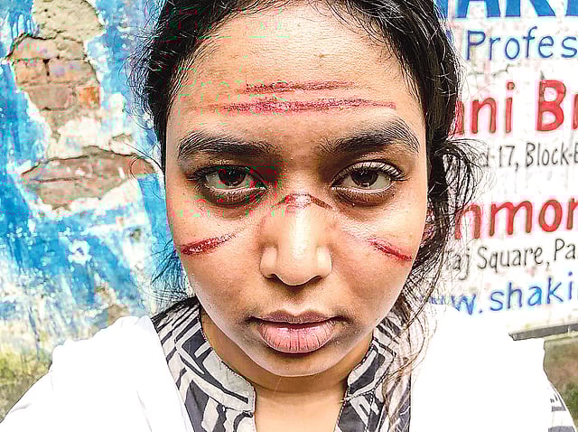 চরিত্রের জন্য মুখে দাগ ফেলেছেন ভাবনা। ছবি: সংগৃহীত