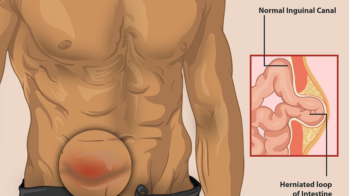 ছবি: উইকিমিডিয়া কমনস