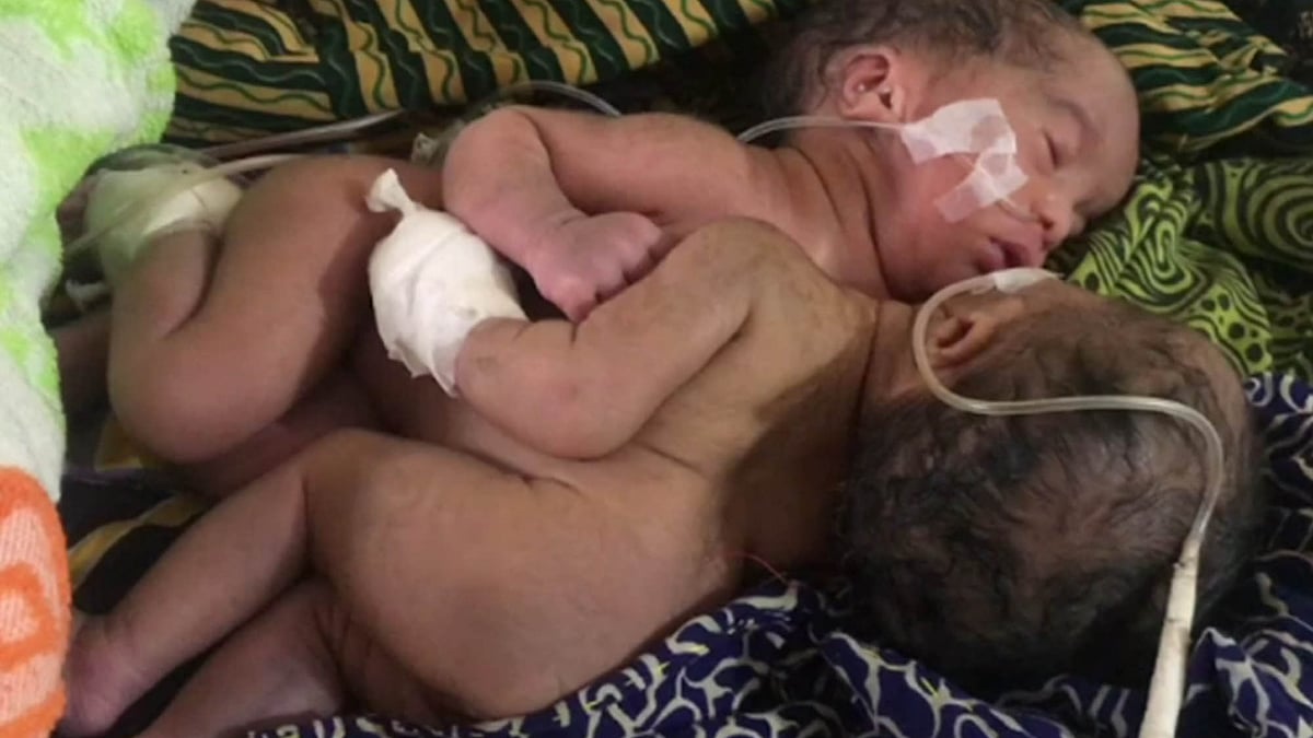 প্রথম আলো