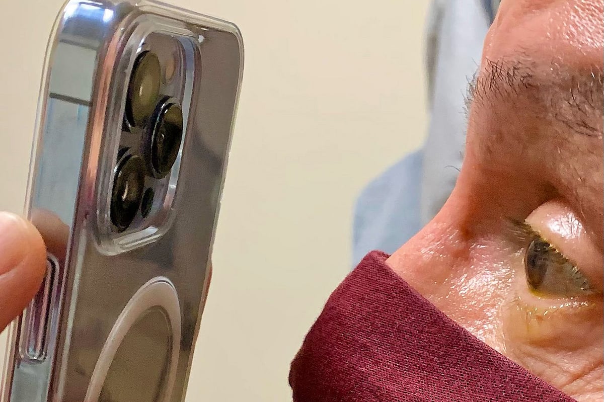 টমি কর্ন