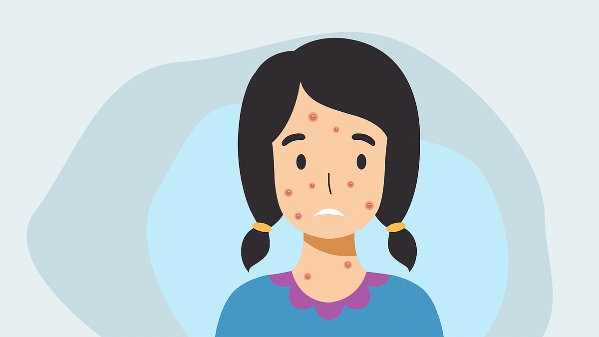 প্রতীকী ছবি 