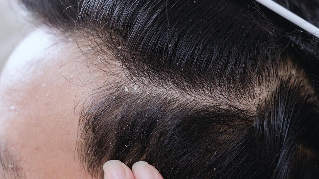 প্রতীকী ছবি