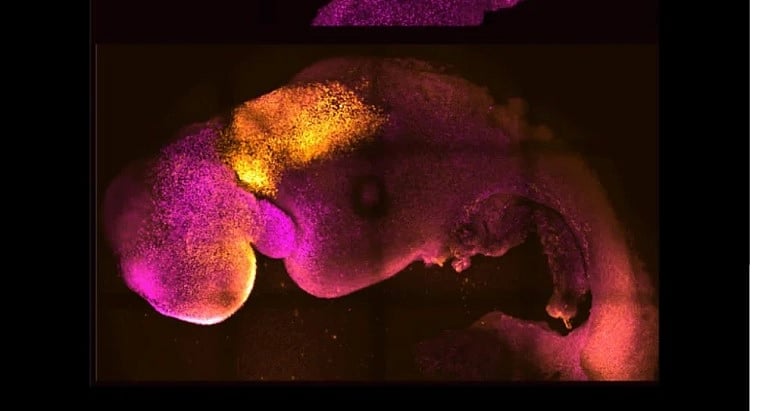 ছবি: কেমব্রিজ বিশ্ববিদ্যালয়ের সৌজন্যে