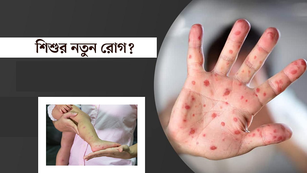 প্রথম আলো গ্রাফিকস