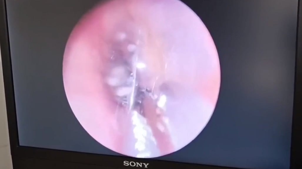 ছবি: ভিডিও থেকে নেওয়া