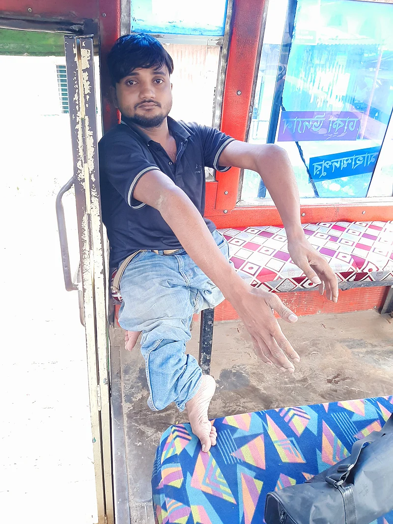 নূর আলম বলেন, দুই হাতে ভর দিয়ে চলতে চলতে তাঁর হাত দুটিও বাঁকা হয়ে যাচ্ছে