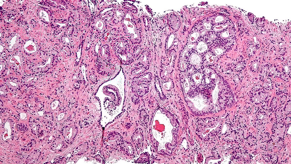 ছবি: উইকি মিডিয়া
