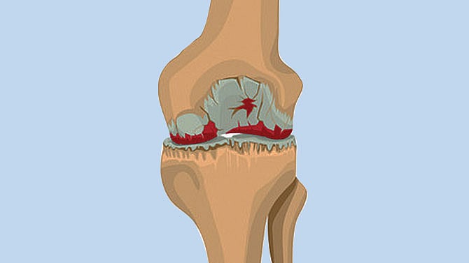 প্রতীকী ছবি 