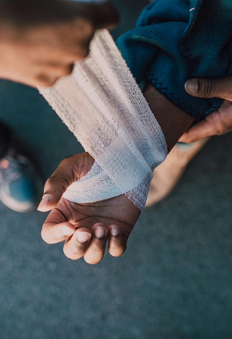 পোড়া ক্ষতের প্রাথমিক চিকিৎসার যে ধাপগুলো বাঁচাতে পারে প্রাণ