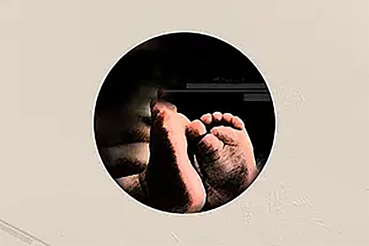 নবজাতকের লাশপ্রতীকী ছবি