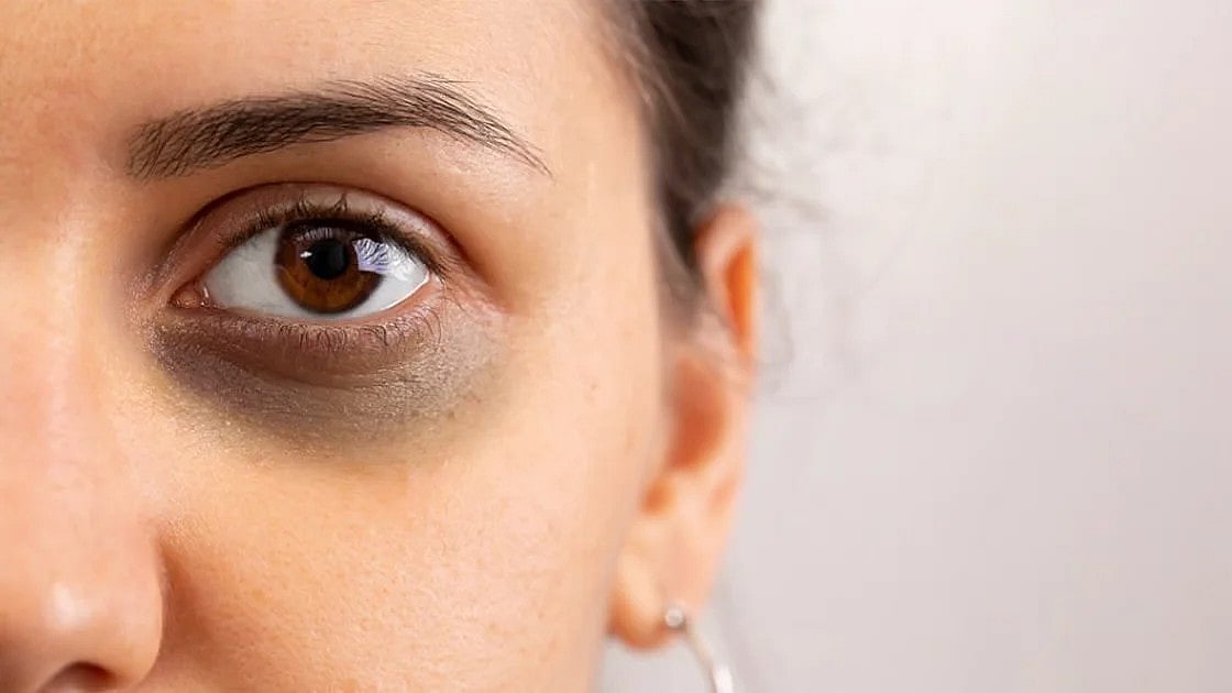 সঙ্গীর ভুলে নারী যেসব সমস্যায় ভুগতে পারেন