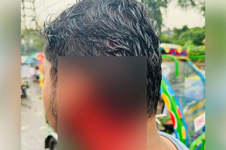 জাহাঙ্গীরনগর বিশ্ববিদ্যালয়ের এক শিক্ষার্থীকে রড দিয়ে পিটিয়ে মাথা ফাটানোর অভিযোগ উঠেছেছবি: সংগৃহীত