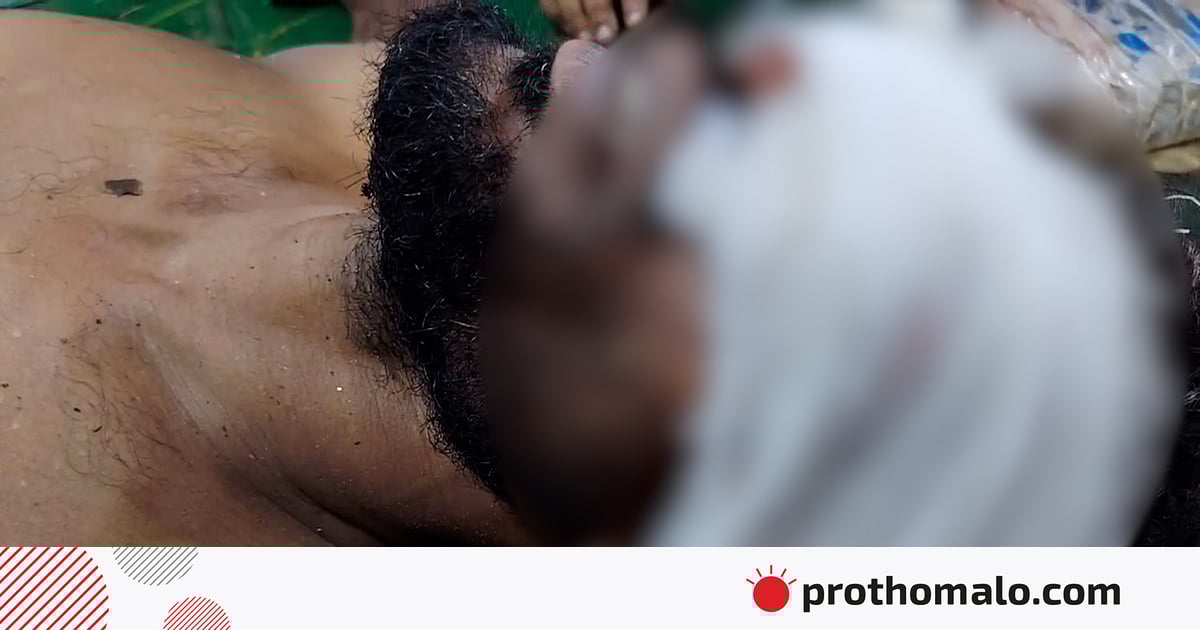 অটোরিকশাচালকের দুই চোখ উপড়ে ফেলায় অভিযুক্তের বাড়িতে আগুন