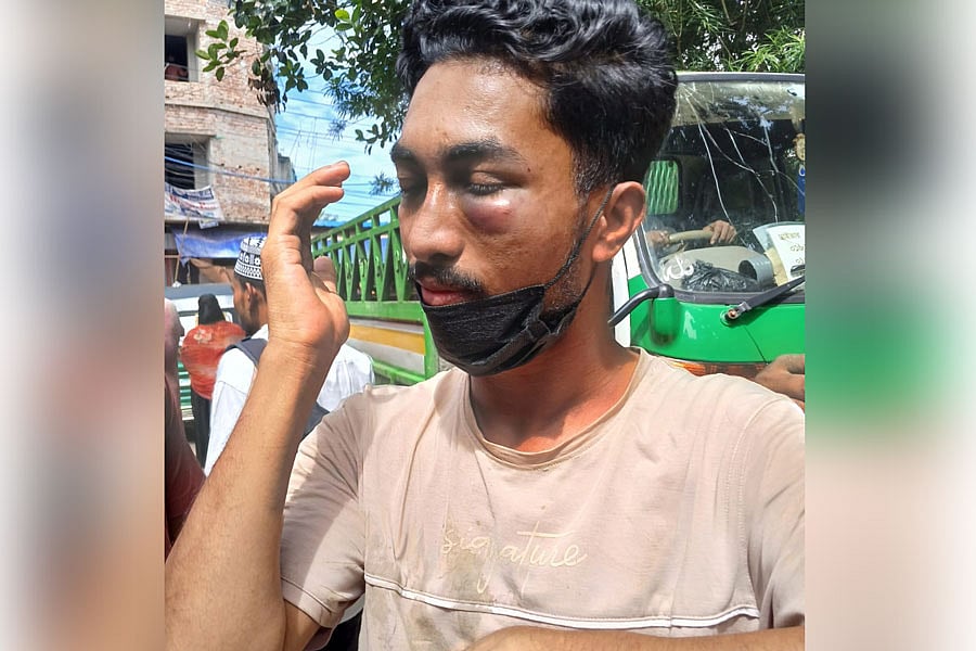 চট্টগ্রামের পটিয়ায় ব্যবসায়ী নুরুল আবছারকে তুলে নিয়ে মারধর করে সন্ত্রাসীরা। আজ সকালে তোলাপ্রথম আলো