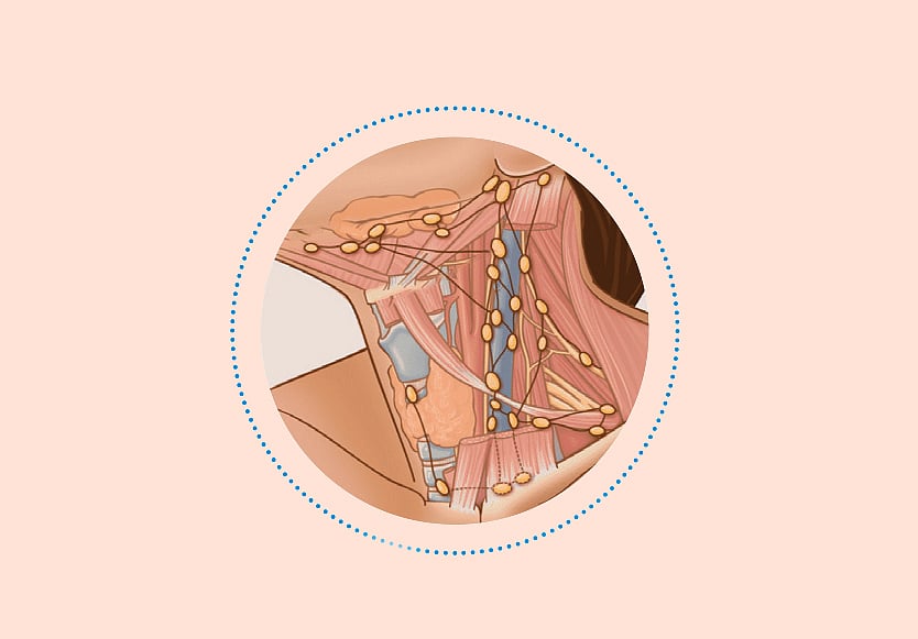 লসিকা গ্রন্থির ক্যানসারের চিকিৎসায় আশার আলো