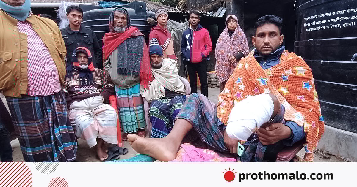 ‘ডাকাইতের গুলিতে এক পা হারালাম; তবু তো বাঁইচে আছি, এইডা সান্ত্বনা’ ‘ডাকাইতের গুলিতে এক পা হারালাম; তবু তো বাঁইচে আছি, এইডা সান্ত্বনা’