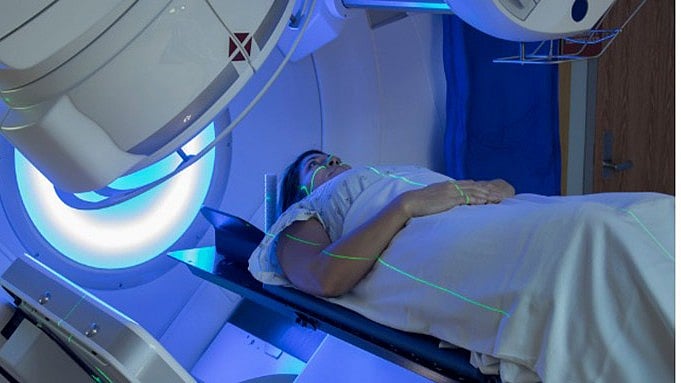 জরায়ুমুখের ক্যানসার চিকিৎসায় রেডিওথেরাপি কী, কীভাবে কাজ করে