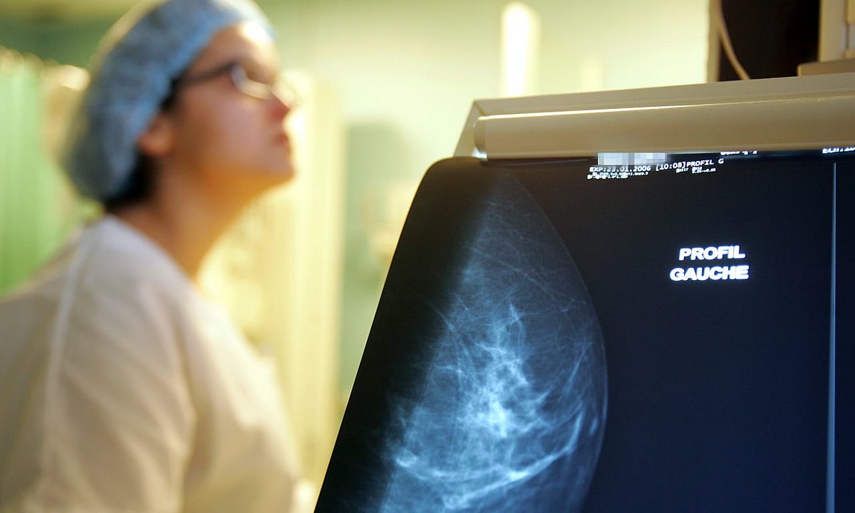 স্তন ক্যানসার শনাক্তে চিকিৎসকদের জন্য সহায়ক হতে পারে এআই: গবেষণা