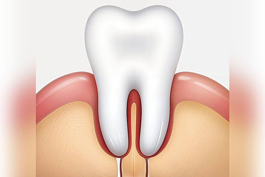 হঠাৎ দাঁতে ব্যথা, কী করবেন 