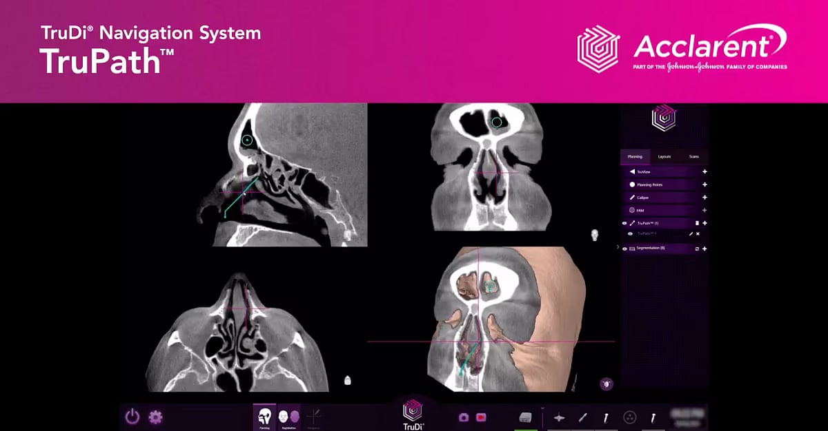অস্ত্রোপচারে এআই: ভুল চিকিৎসা ও ভুল অঙ্গ শনাক্তের অভিযোগ