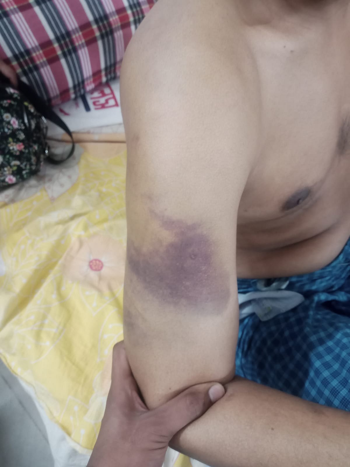 মাদকাসক্তি নিরাময়কেন্দ্রে মানসিক ভারসাম্যহীন যুবককে নির্যাতন