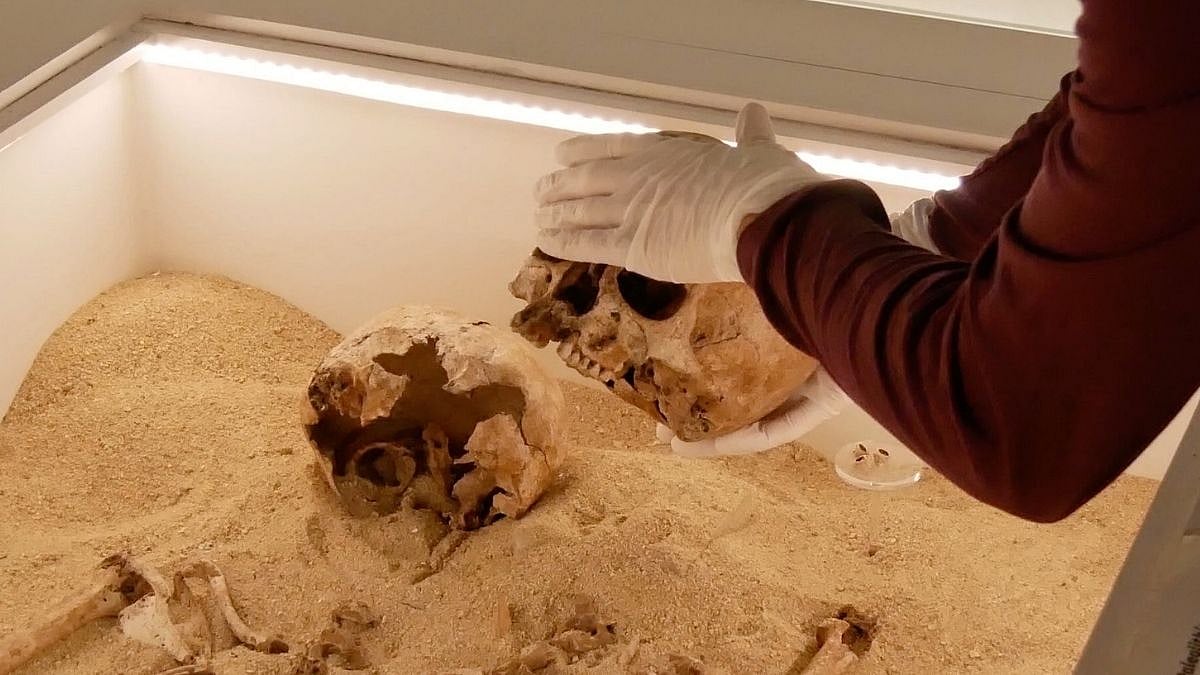 ১২ হাজার বছরের বেশি পুরোনো মানুষের কঙ্কালে বিরল রোগের সন্ধান