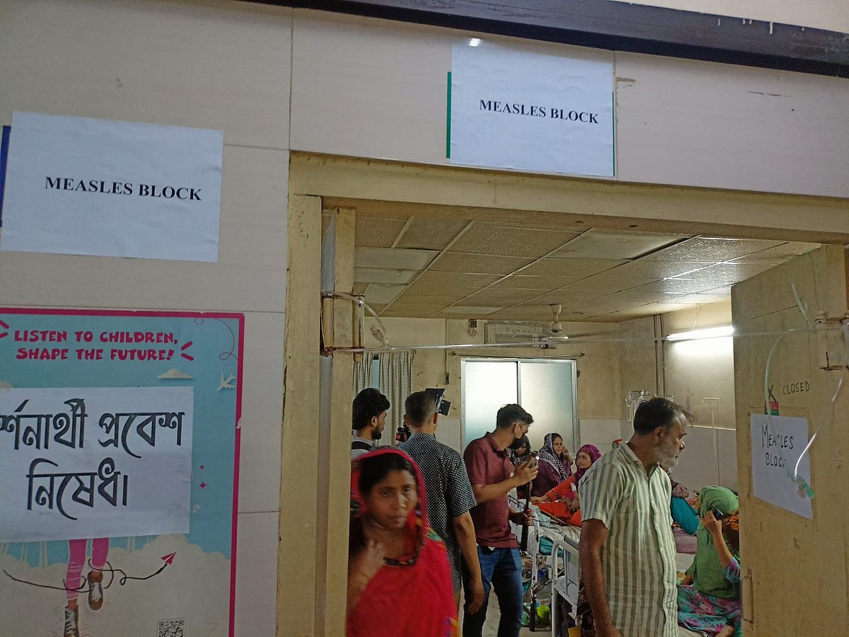 চট্টগ্রামে দুই শিশুর শরীরে হাম, ৪০ জনের নমুনা ঢাকায়