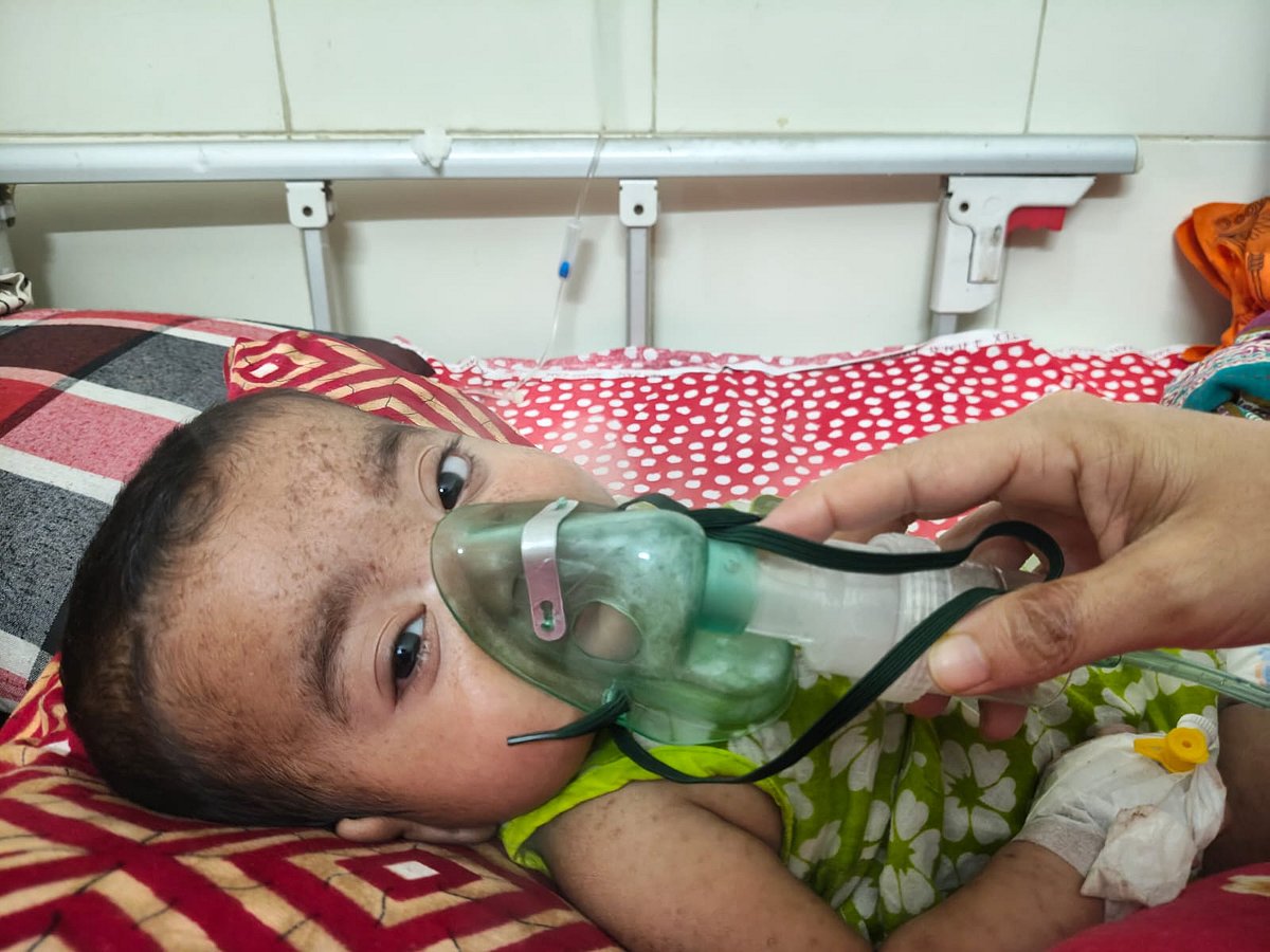 ময়মনসিংহ মেডিকেলে হামের লক্ষণ নিয়ে ২৪ ঘণ্টায় ২১ শিশু ভর্তি