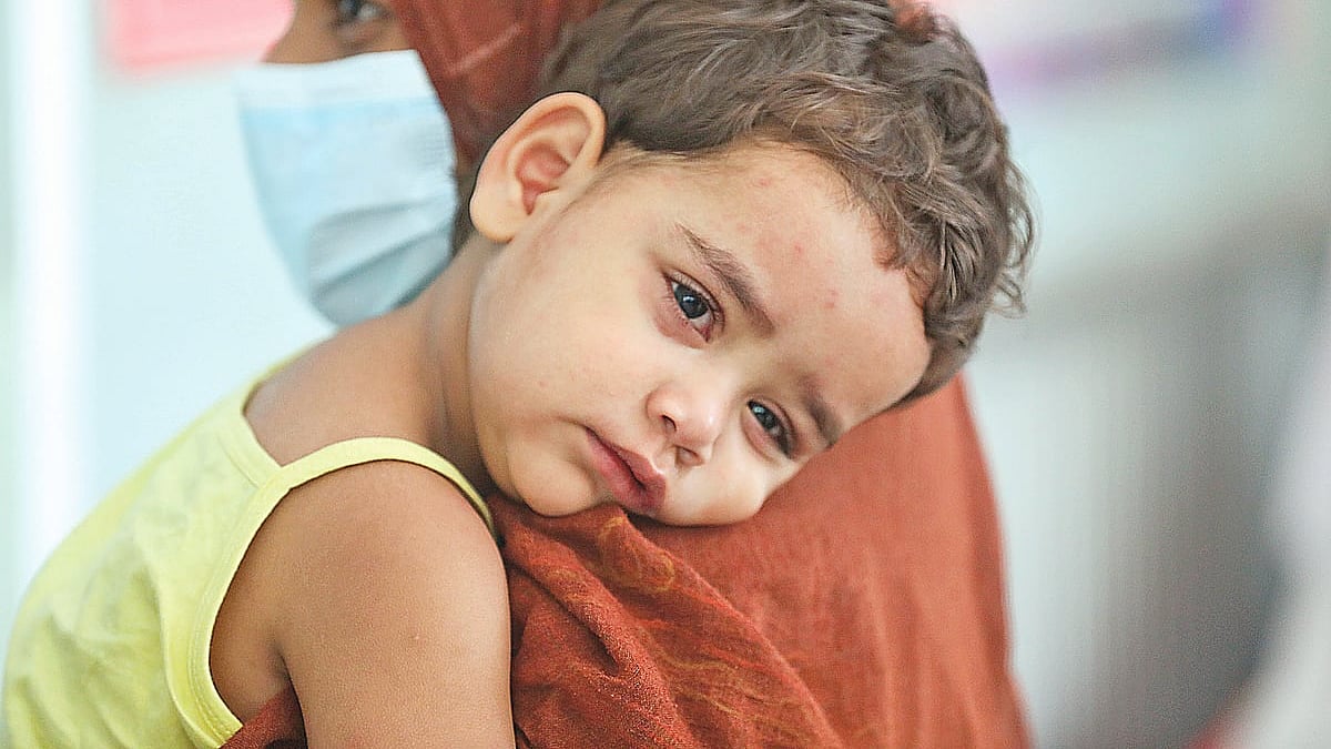 হামে আক্রান্ত ২০ মাস বয়সী শিশু মাইশা তুন নূরকে পুরান ঢাকার মিটফোর্ড হাসপাতাল থেকে মহাখালীর ডিএনসিসি কোভিড-১৯ ডেডিকেটেড হাসপাতালে নিয়ে আসা হয়েছে। শুরুতে জ্বর, সর্দি ও কাশি থাকলেও পরে কাশি বেড়ে যাওয়ায় শিশুটিকে এই হাসপাতালে নিয়ে আসে পরিবার। গতকাল দুপুরে