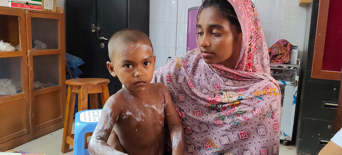 সখীপুরে অ্যাসিডের বোতল নিয়ে খেলতে গিয়ে শিশু দগ্ধ