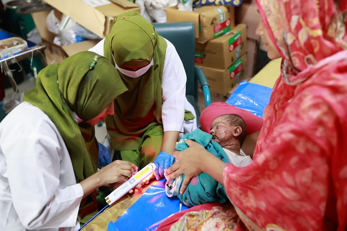 হামে এবং ‘সন্দেহজনক হামে’ আরও ৭ শিশুর মৃত্যু