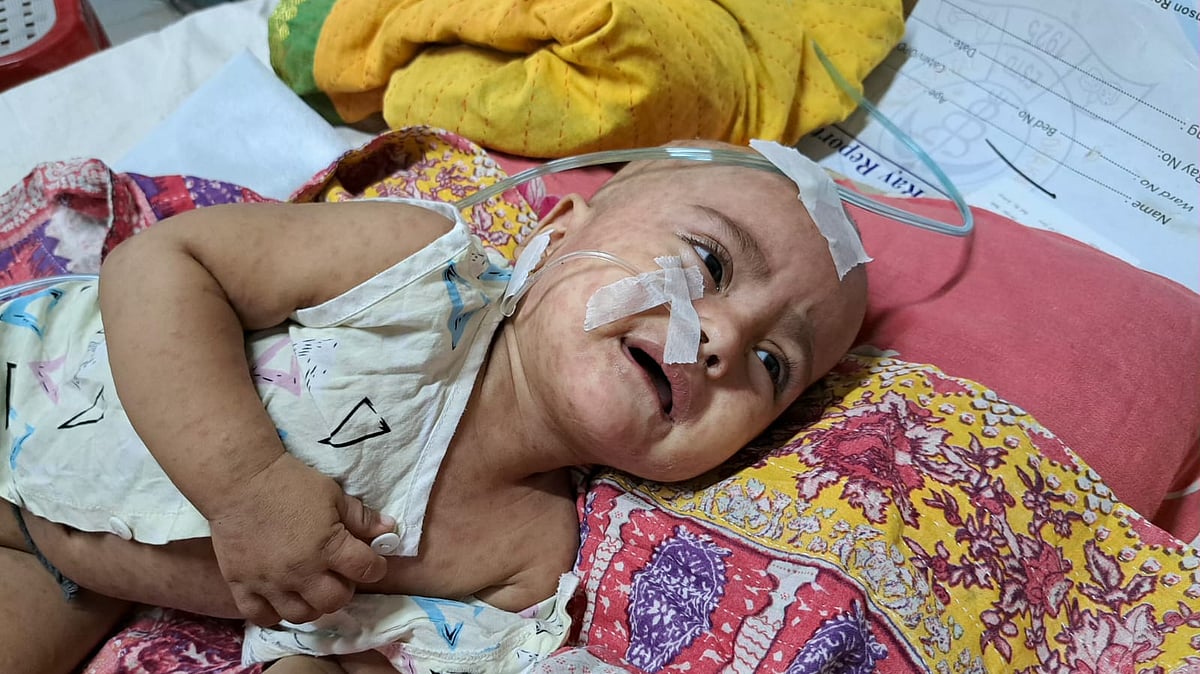 হামের চিকিৎসা: খরচে দিশাহারা অভিভাবকেরা | প্রথম আলো